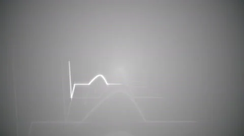 HeartBeat Cardiogram on Gray Background. Stock Footage 58882549