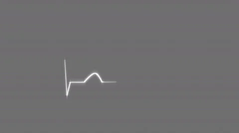 HeartBeat Cardiogram on Grid Background. 스톡 동영상 58882638