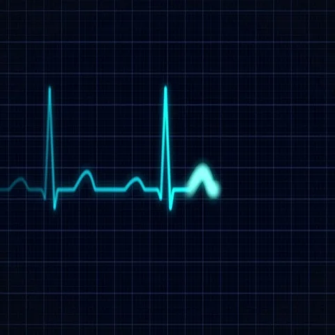 Heartbeat Curve  Stock Footage 69709269