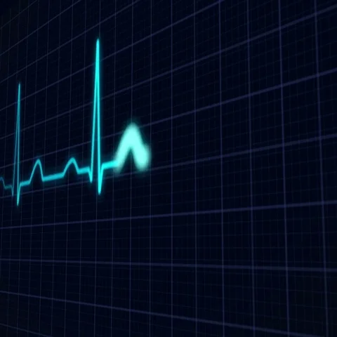Heartbeat Curve  Stock Footage 69709765