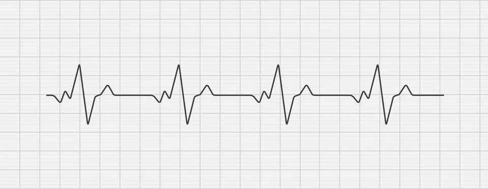 Heartbeat ecg electrocardiogram vector graph wave line. Ekg cardio heart beat Stock Illustration