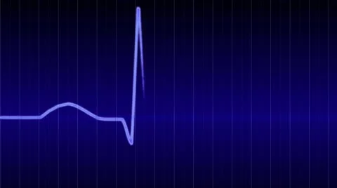 Heartbeat - ECG 스톡 동영상 10786686