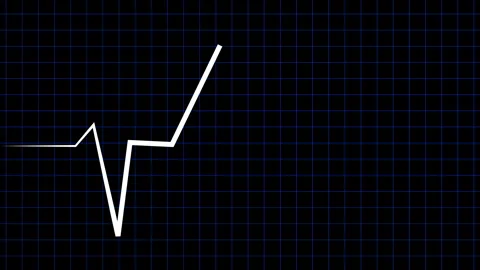 Heartbeat ECG Pulse Blue Grid Animation Dark Video stock 339577145
