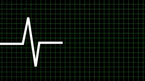 Heartbeat ECG Pulse Green Grid Animation Dark Video stock 339577280