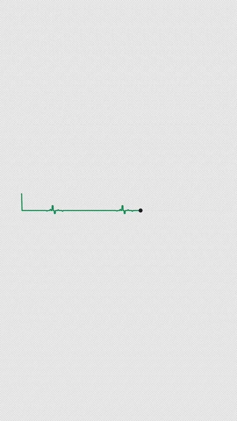 Heartbeat ECG Pulse Line 2Beat Green 2 Beat Overlay Alpha 4K Vertical 9x16 Light Видео 339507648