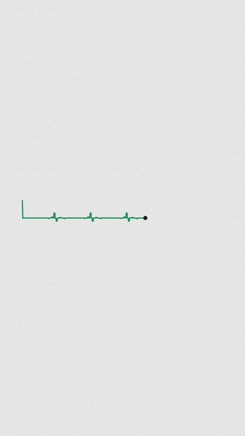 Heartbeat ECG Pulse Line 4Beat Green 4 Beat Overlay Alpha 4K Vertical 9x16 Light 库存影片 339507635