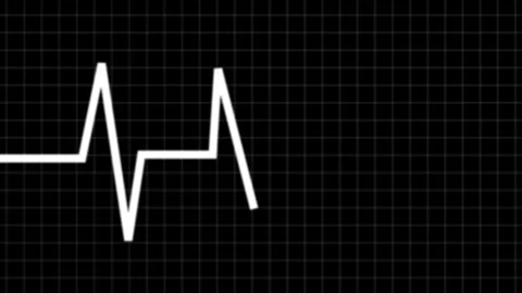 Heartbeat ECG Pulse White Dark Grid Animation 動画素材 339577018