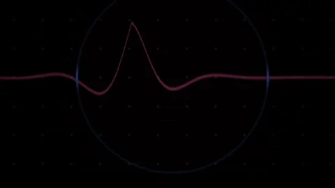 Heartbeat Ecg Waveform Pulse with Blue Circle on Dark Background for Medica.. Stock Footage 343727776