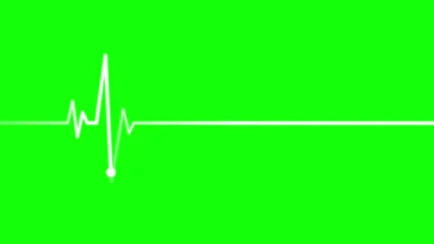 Heartbeat Flatline Animation, ECG Electrocardiogram on Green Screen Stock Footage 315014711