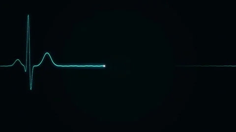 Heartbeat flatline Animation pulse trace Stock Footage 336522684