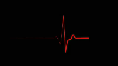 Heartbeat flatline, cardiac impulse sequence on the screen Stock Footage 124680144