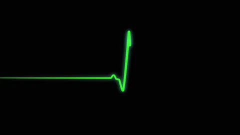 Heartbeat flatline, medical ECG EKG monitor with green line Stock Footage