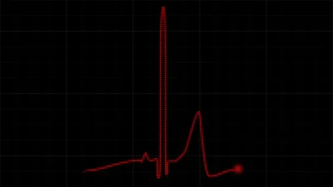 Heartbeat flatline. Seamlessly looping animation. Stock Footage 247667857
