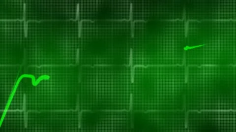 Heartbeat Stock Footage 8970295
