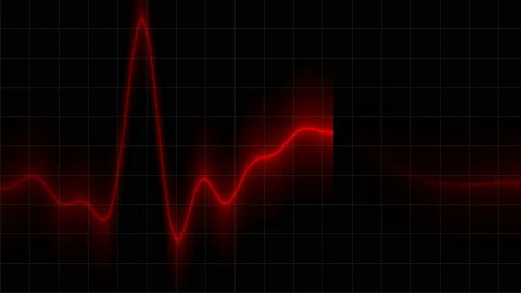Heartbeat Heart Beat Heartrate Monitor Animation Stock Footage