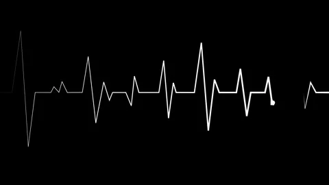 Heartbeat line electrocardiogram pulse pattern medical and health concept a.. Stock Footage 340384419