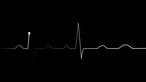 Heartbeat line electrocardiogram style pulse trace with sharp spikes and fl.. Stock Footage 340387060