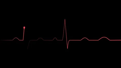 Heartbeat line electrocardiogram style pulse trace with sharp spikes and fl.. Stock Footage 340387075