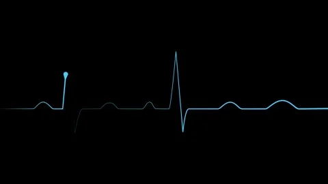 Heartbeat line electrocardiogram style pulse trace with sharp spikes and fl.. Stock Footage 340387085