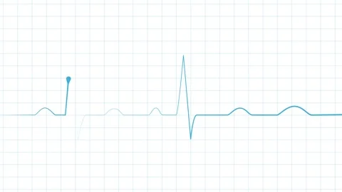 Heartbeat line electrocardiogram style pulse trace with sharp spikes and fl.. Stock Footage 340387206