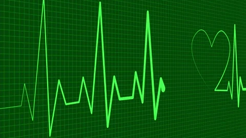 Heartbeat Line Forming Heart Shape on Grid Animation, heartbeat line formin.. Vidéo 305167598