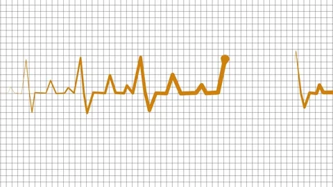 Heartbeat line on graph paper background,showing a medical electrocardiogra.. Stock Footage 336906119