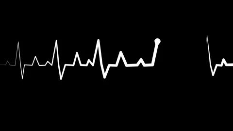 Heartbeat line on graph paper background,showing a medical electrocardiogra.. Stock Footage 336906212