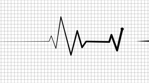 Heartbeat line on graph paper with copy space showing medical monitoring pu.. Stock Footage 336904916