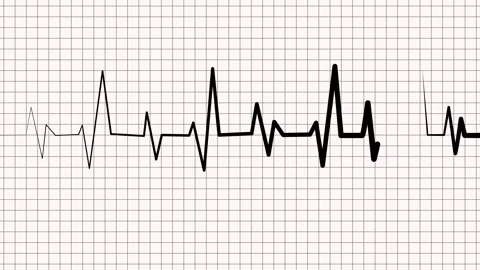 Heartbeat line on graph paper showing an ecg style rhythm pattern animation Stock Footage 336905634