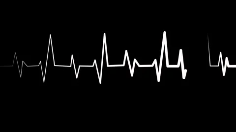 Heartbeat line on graph paper showing an ecg style rhythm pattern animation Stock Footage 336905644