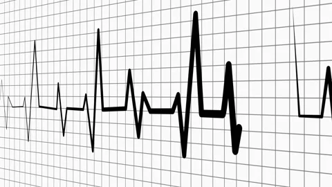 Heartbeat line on graph paper showing an ecg style rhythm pattern animation Stock Footage 336905668