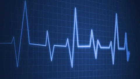 Heartbeat line on graph paper showing an ecg style rhythm pattern animation Stock Footage 336905695