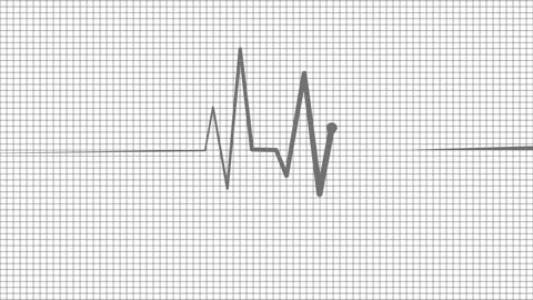 Heartbeat line on grid background animation Stock Footage 329115950