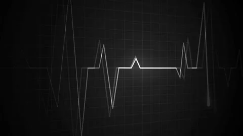 Heartbeat line on a grid pulse pattern for health medicine and emergency mo.. Stock Footage 340385009