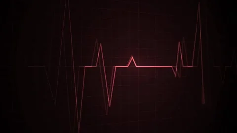 Heartbeat line on a grid pulse pattern for health medicine and emergency mo.. Stock Footage 340385017
