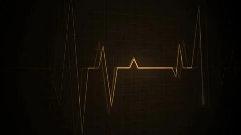 Heartbeat line on a grid pulse pattern for health medicine and emergency mo.. Stock Footage 340385040
