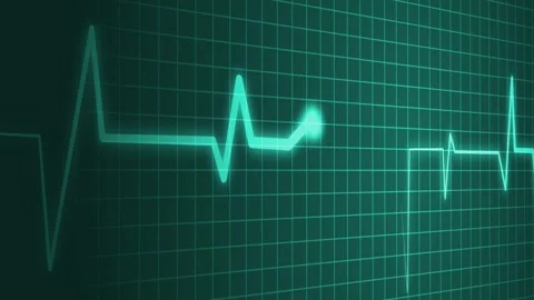 Heartbeat line irregular electrocardiogram pattern animation Stock Footage 336906610