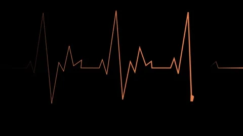 Heartbeat line pulse rhythm and sharp peaks simple medical concept for heal.. Stock Footage 340384134