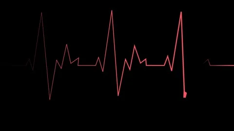 Heartbeat line pulse rhythm and sharp peaks simple medical concept for heal.. Stock Footage 340385193