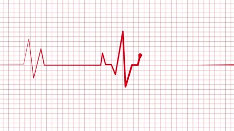 Heartbeat line pulse spike and flat line medical concept for heart health m.. Vidéo 337181777
