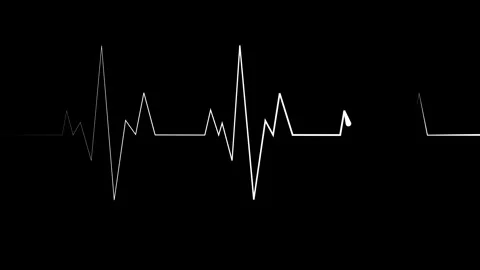 Heartbeat line sharp spikes and flat sections minimal abstract medical puls.. Stock Footage 340386683
