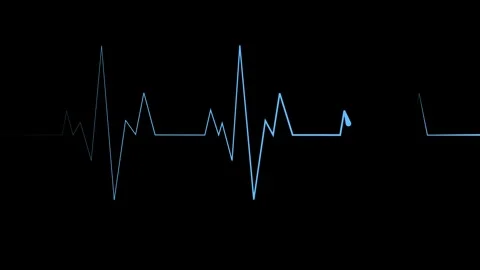 Heartbeat line sharp spikes and flat sections minimal abstract medical puls.. Stock Footage 340386694