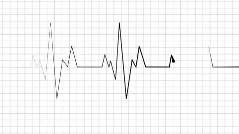 Heartbeat line sharp spikes and flat sections minimal abstract medical puls.. Stock Footage 340386709