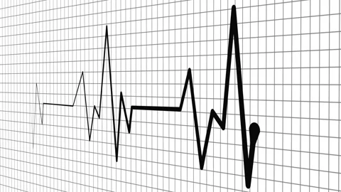 Heartbeat line showing an irregular electrocardiogram style signal, medical.. Stock Footage 336904891