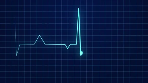 Heartbeat lines animation background created with computer graphics. Loop. Stock Footage 197643892