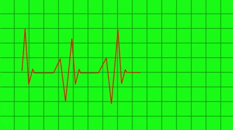 Heartbeat lines animation - greencreen effect Video stock 34127927
