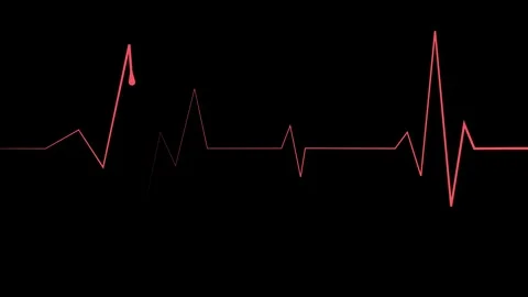 Heartbeat lines electrocardiogram style pulse with sharp spikes and flat se.. Stock Footage 340384243