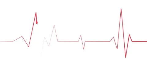 Heartbeat lines electrocardiogram style pulse with sharp spikes and flat se.. Stock Footage 340384283
