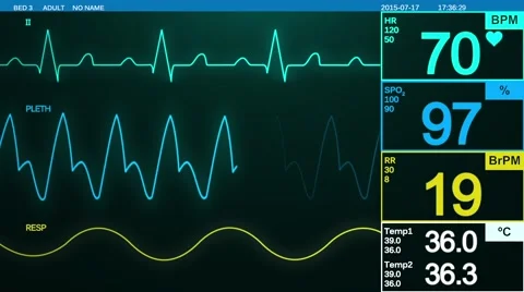 Medical Monitor Screen On Normal Heart Stock Footage Video (100