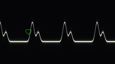 Heartbeat pattern with a heart symbol in a dark background Stock Footage 339071818